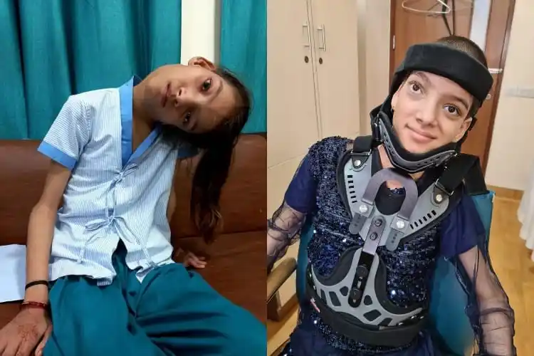 Pakistani teenager Afsheen Gul before and after her surgery.