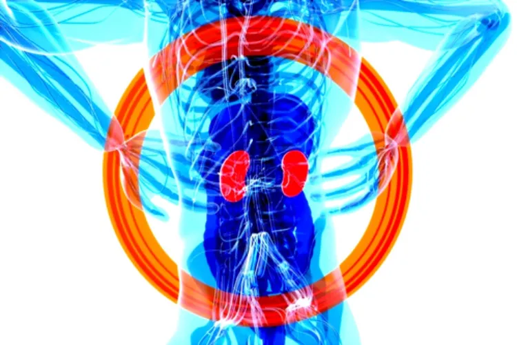 Representational image of kidney infection