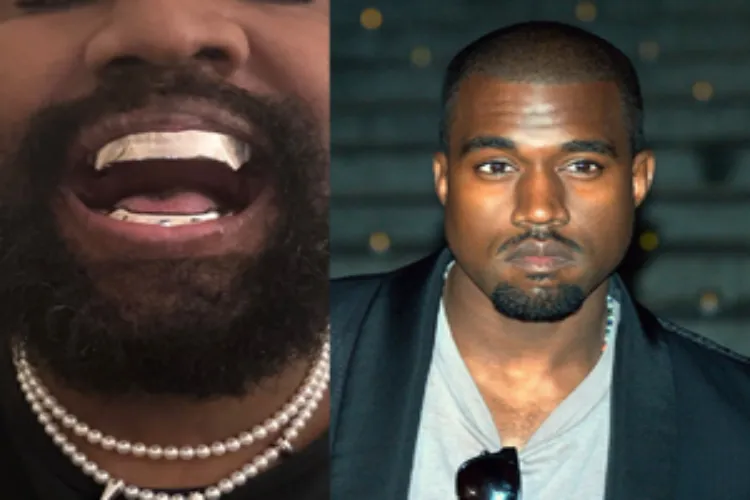 American rapper replaces teeth with titanium gnashers