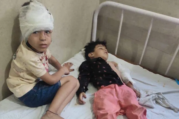 Two children injured in the terror attack induced bus accident in Reasi, Jammu in hospital