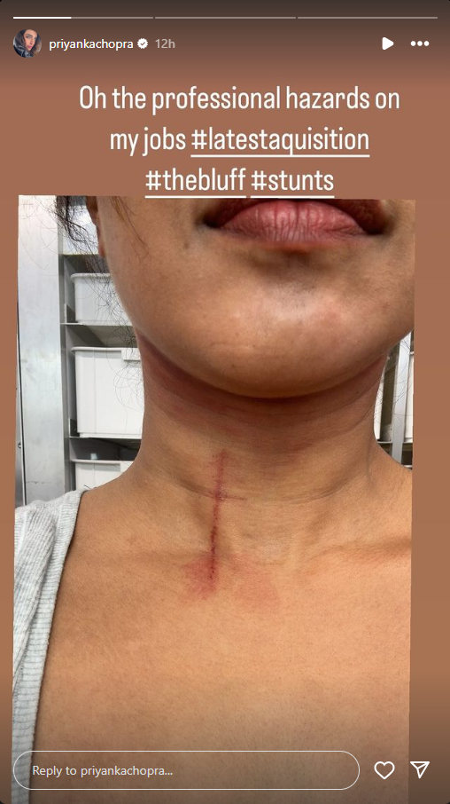 https://www.awazthevoice.in/upload/news/1718792339Priyanka_Chopra.png