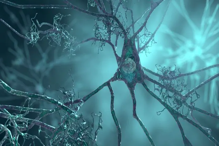 Researchers identify brain vascular changes linked to Alzheimer's