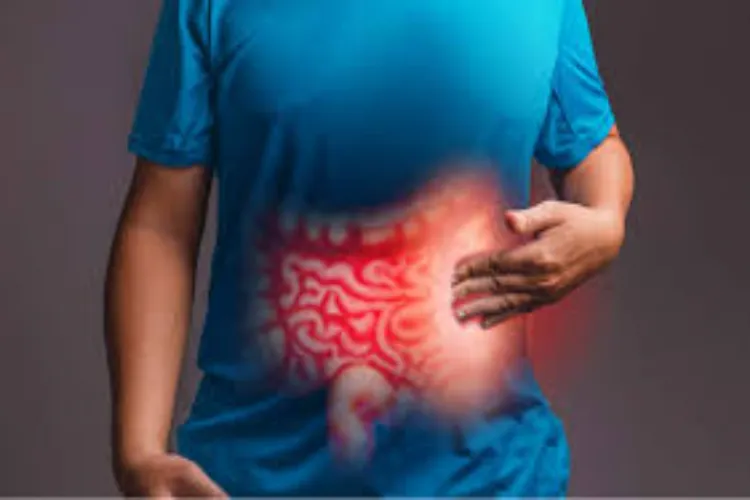 Representational image of colon cancer