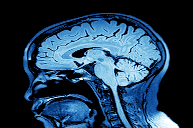 Image of a brain scan