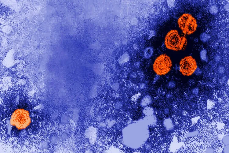 Representational image 