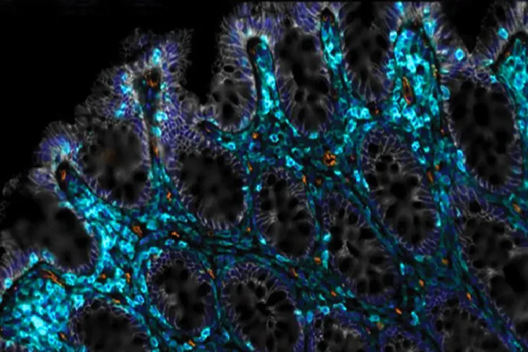 Representational Image